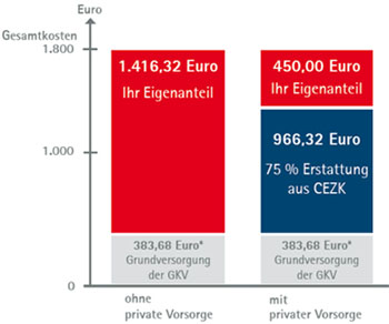 Ein Leistungsbeispiel Tarif CEZK